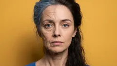 Hoe krijg je je huid weer strak?